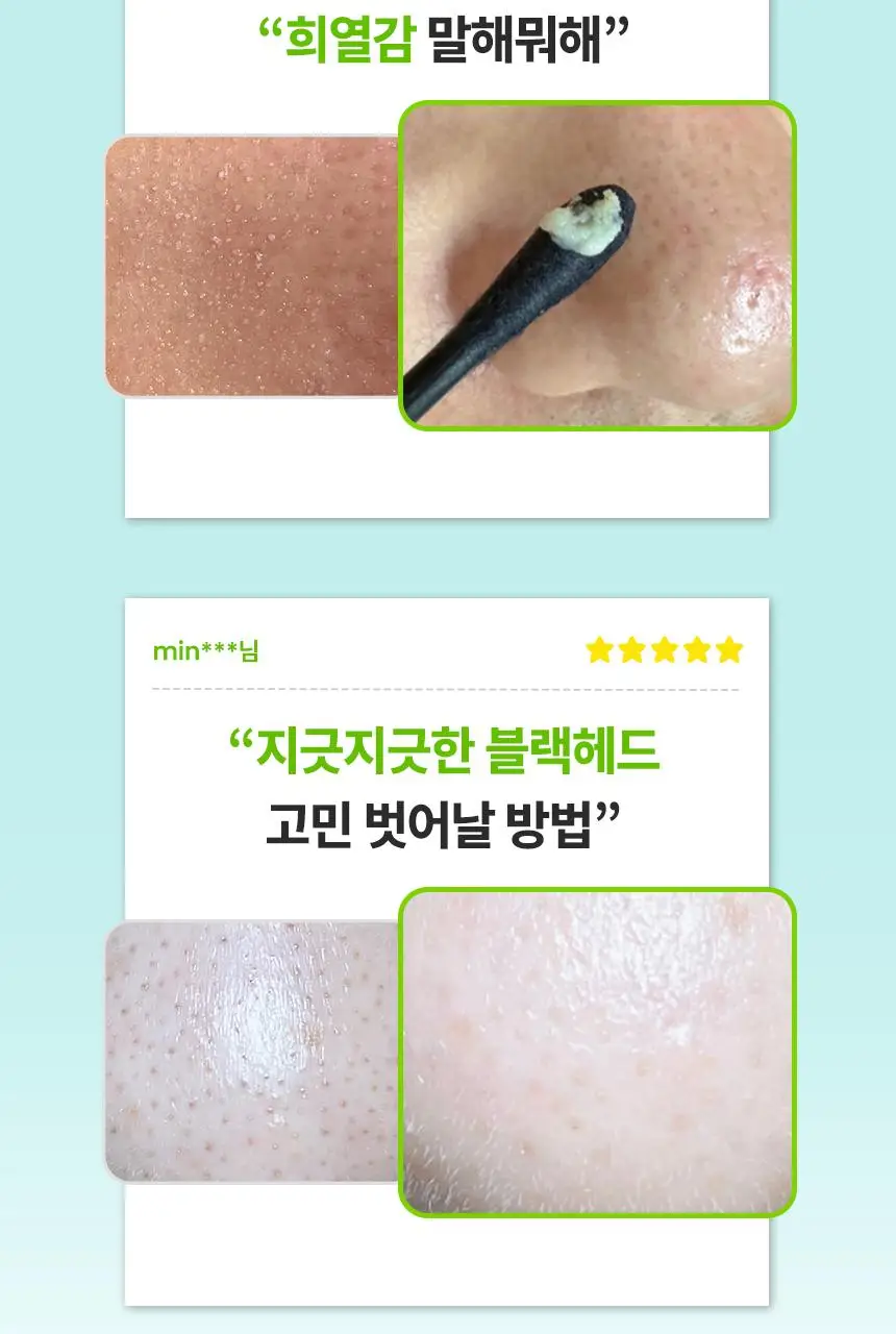 [7월 올영픽/짱구 콜라보] 일소 네추럴 마일드 클리어 노우즈 팩 10매 기획 (+그립톡+면봉20개) 상세페이지 13